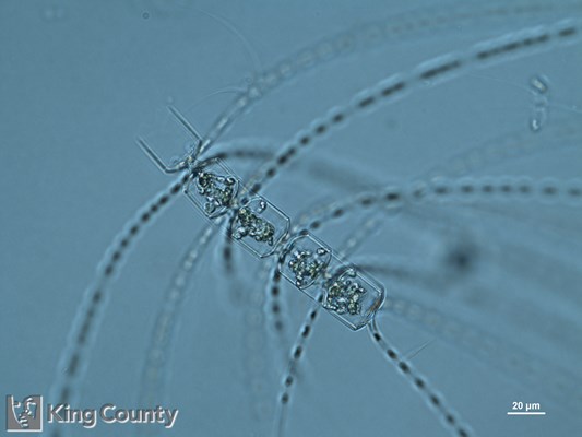 Photo of Chaetoceros eibenii